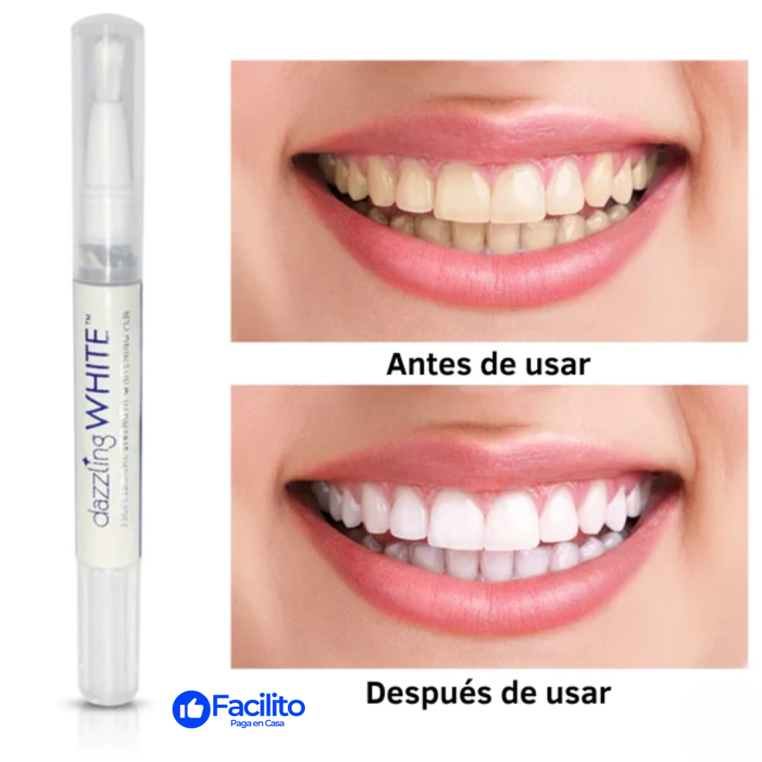 MySmile™ - Bolígrafo blanqueador de dientes (OFERTA EXCLUSIVA 2 X 1)