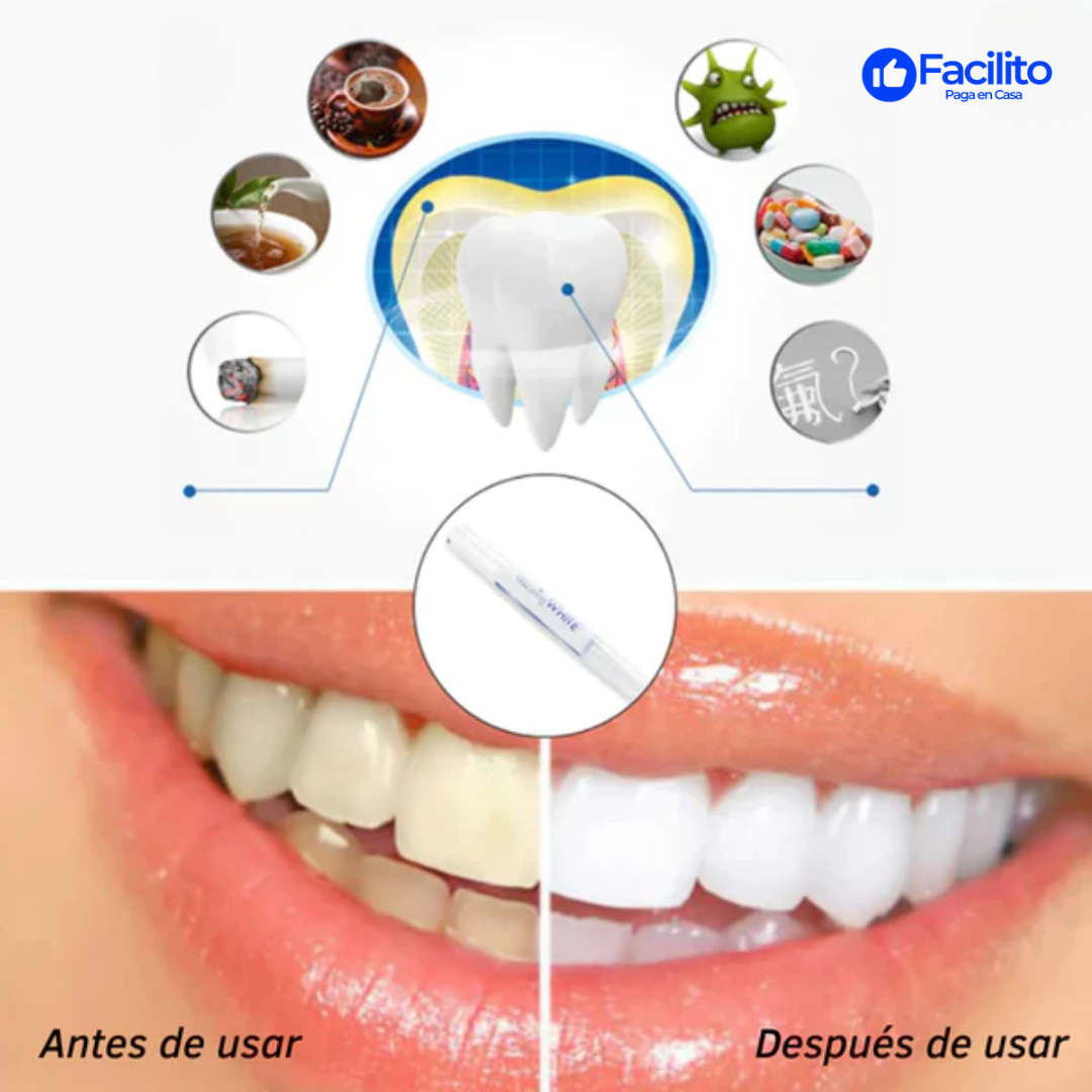 MySmile™ - Bolígrafo blanqueador de dientes (OFERTA EXCLUSIVA 2 X 1)