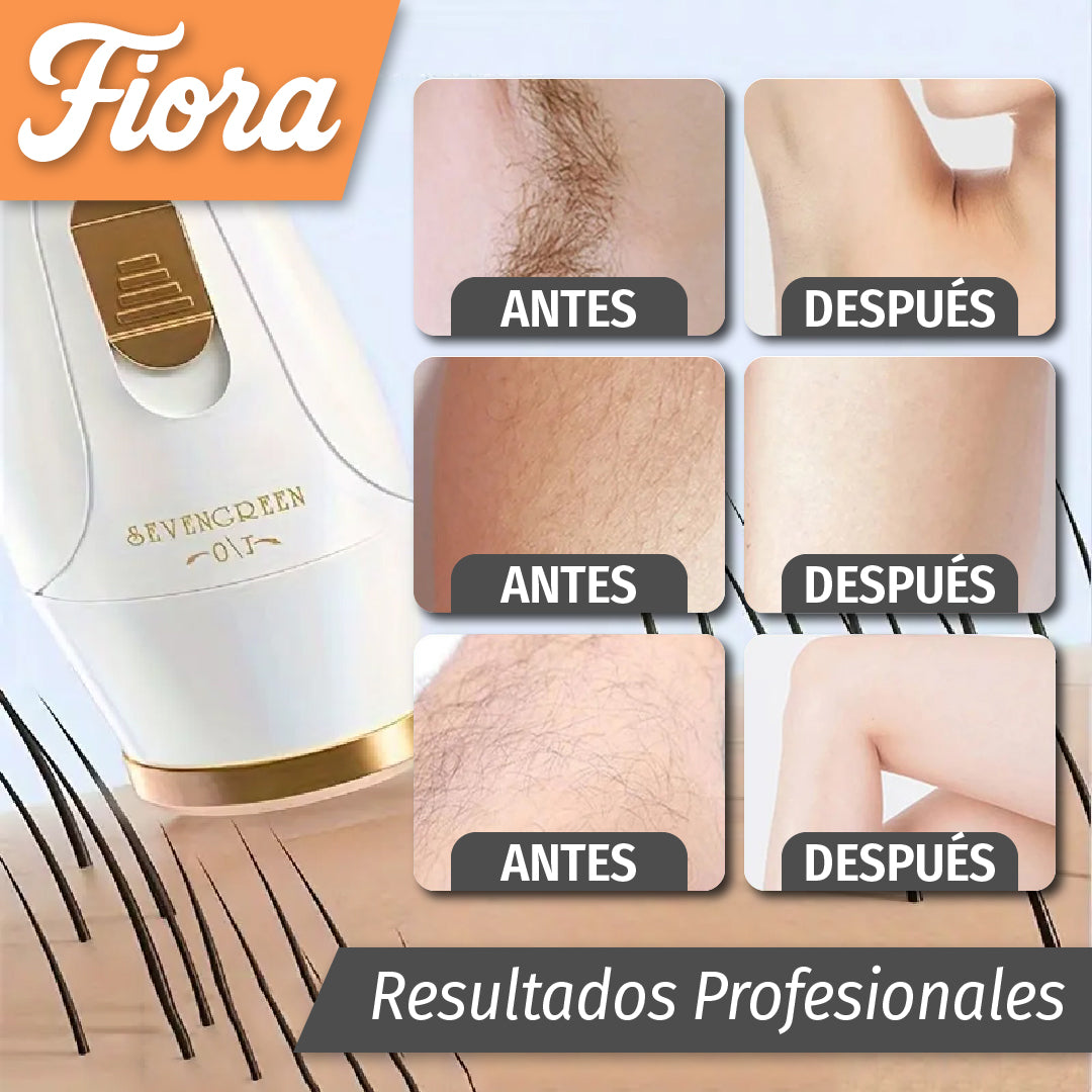Fiora™ - Maquina Depiladora 3 en 1