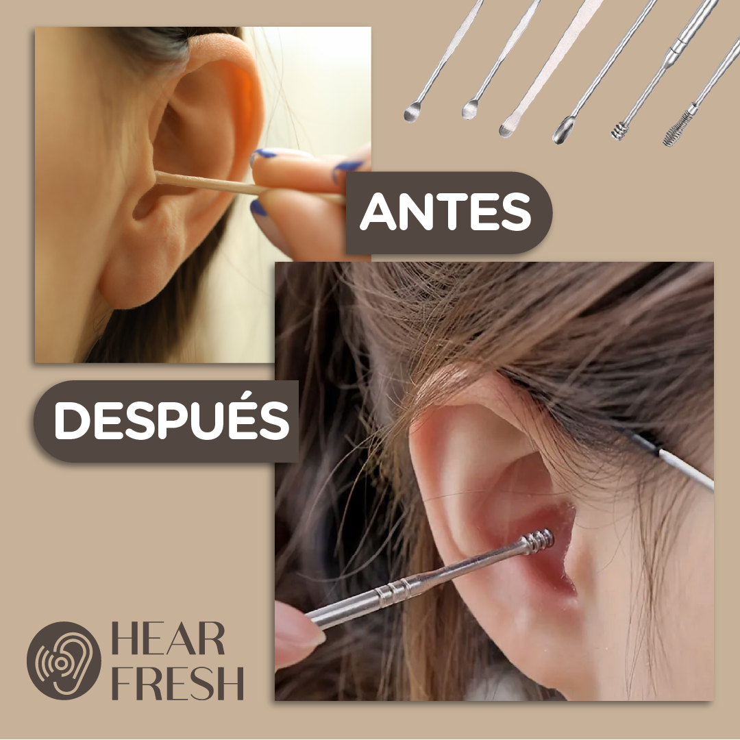 HearFresh™ - Set de Limpieza de Oídos Profesional