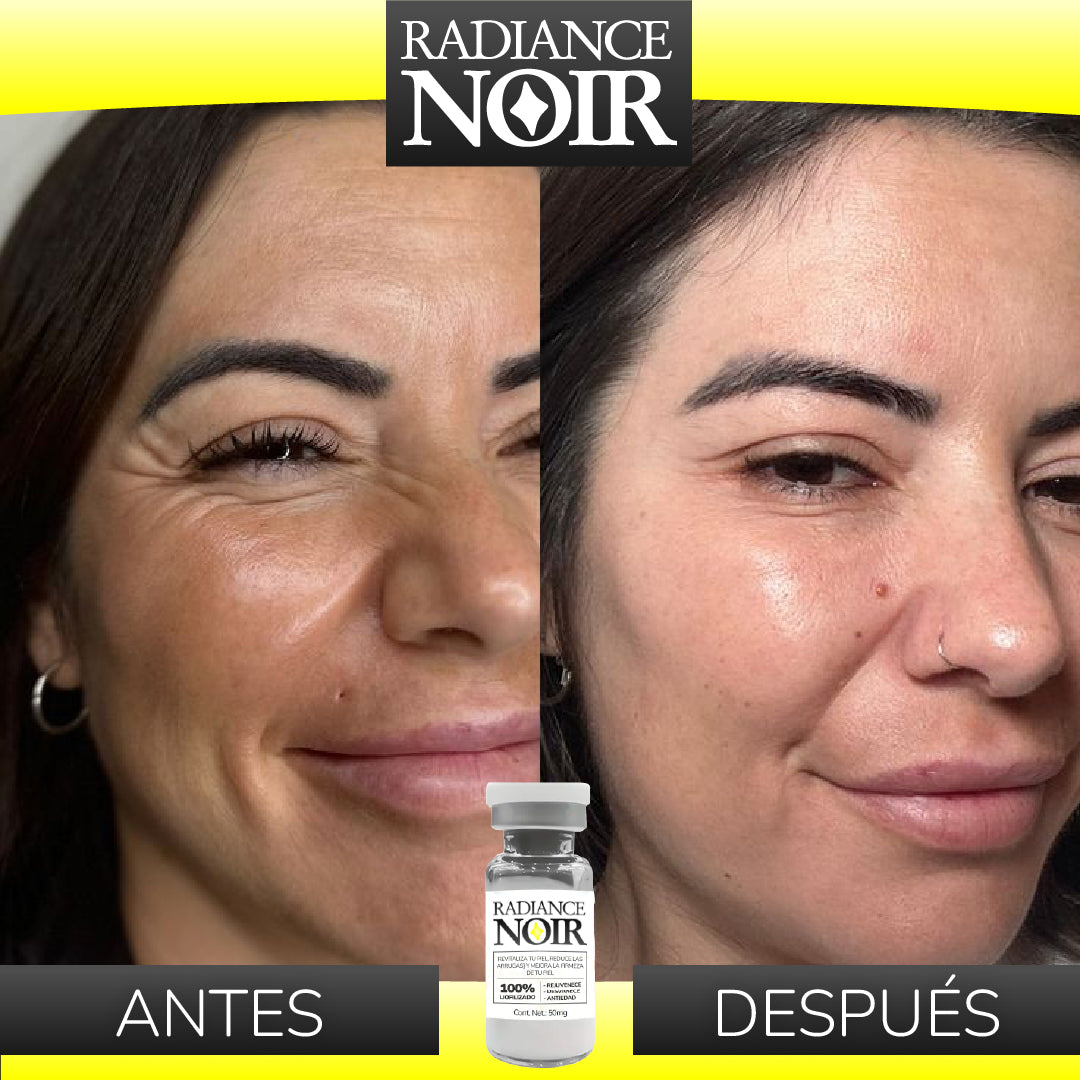 Radiance Noir™ - Kit de Polvos Antivejez