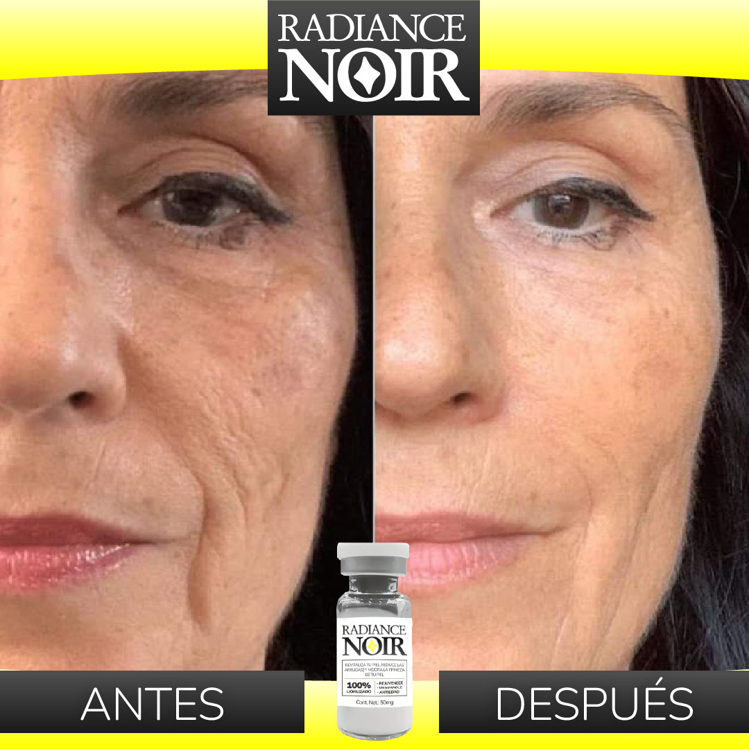 Radiance Noir™ - Kit de Polvos Antivejez