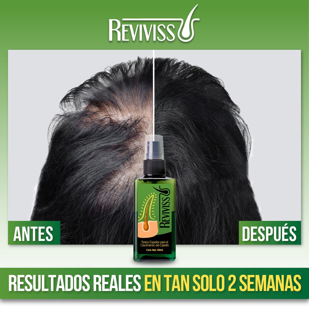 Reviviss™ - Revive tu Cabello desde la Raíz