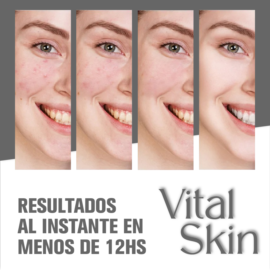 VitalSkin™ - Crema Limpiadora de Colageno