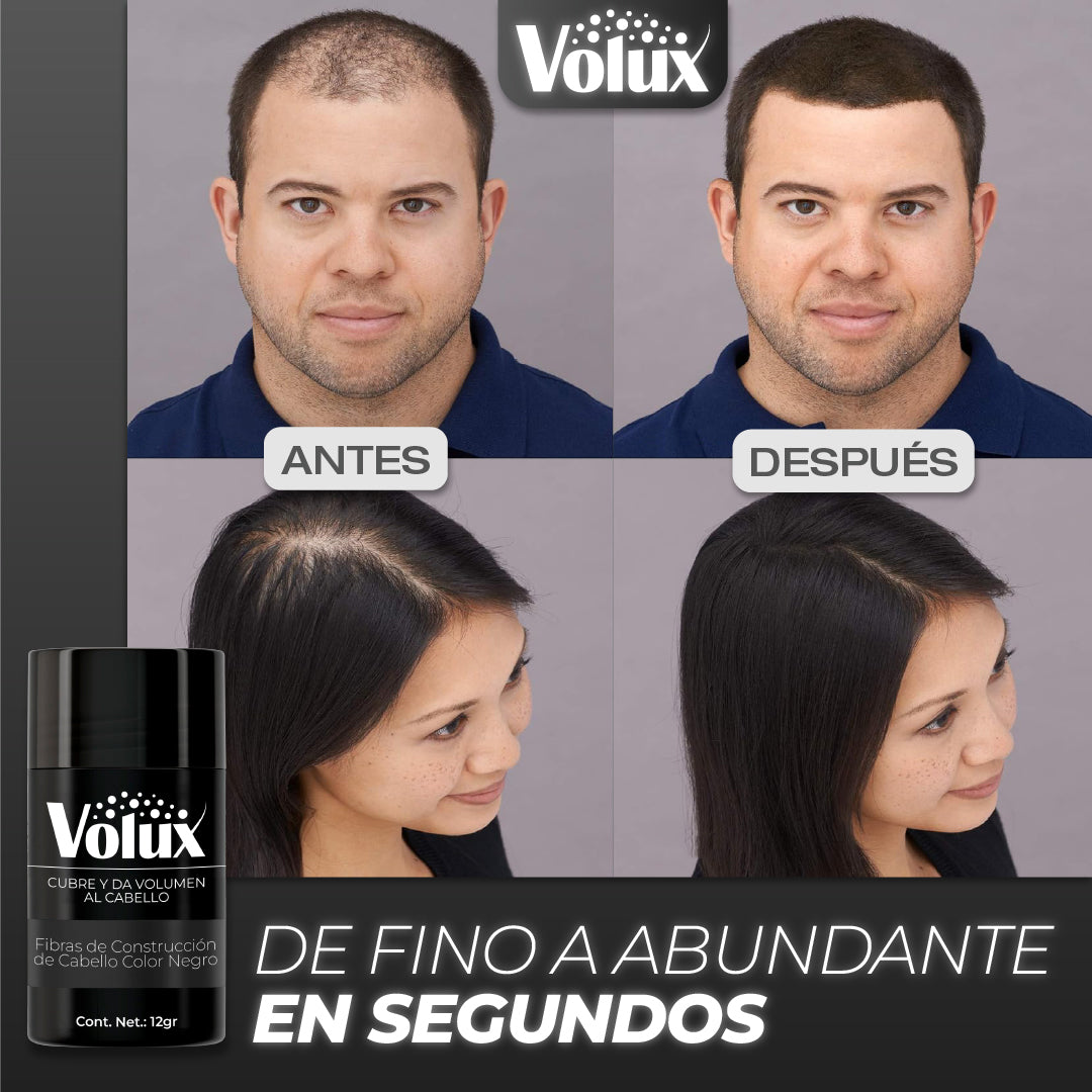 Volux™ - Dale Vida a tu Cabello en Segundos