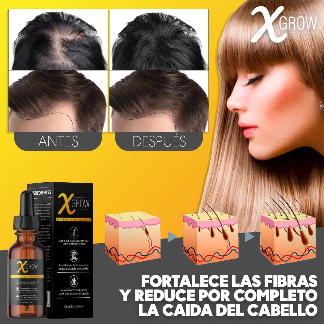 X-GROW™ - Aceite Anti Caida Para Cabellos