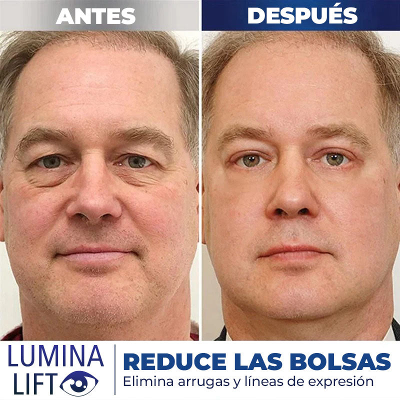 LuminaLift™ - Crema Antienvejezimiento para ojos