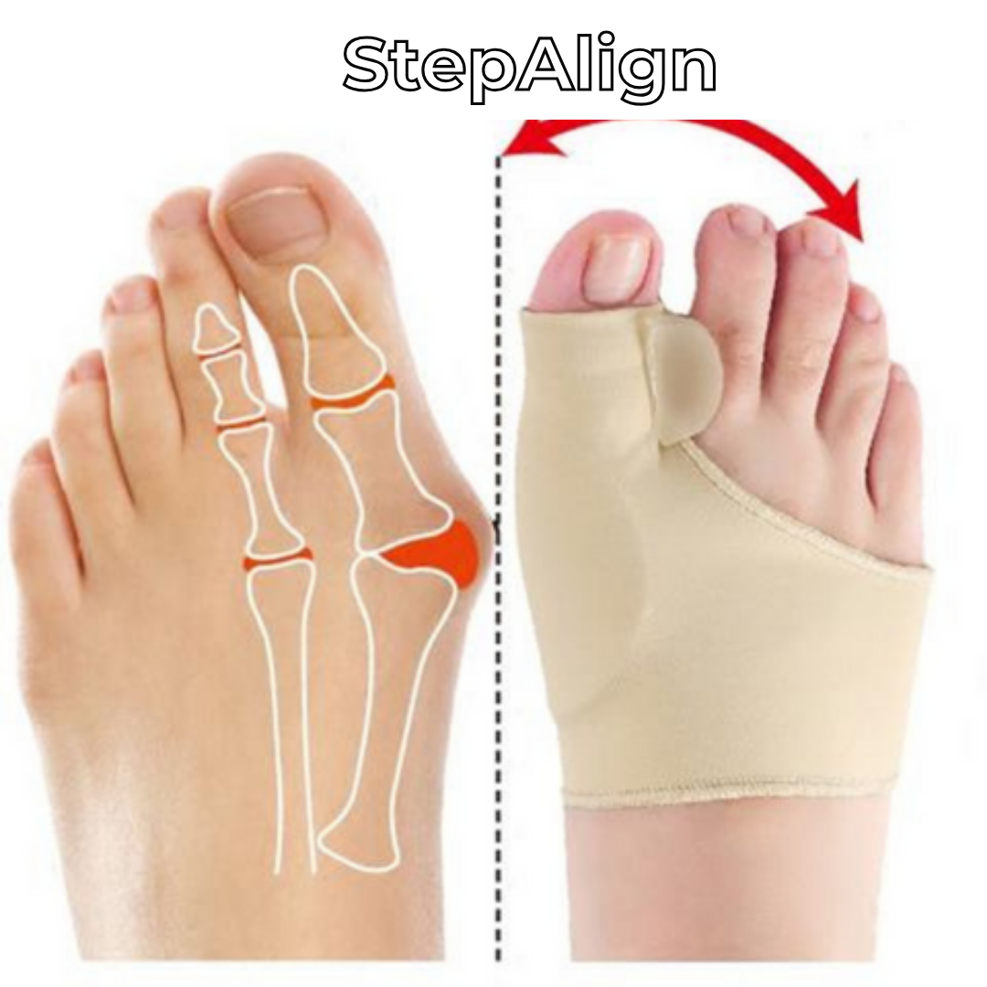 StepAlign™ - Corrector ortopédico para pies