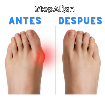 StepAlign™ - Corrector ortopédico para pies