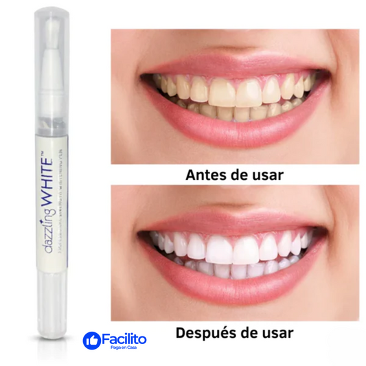 MySmile™ - Bolígrafo blanqueador de dientes (OFERTA  EXCLUSIVA  2 X 1)