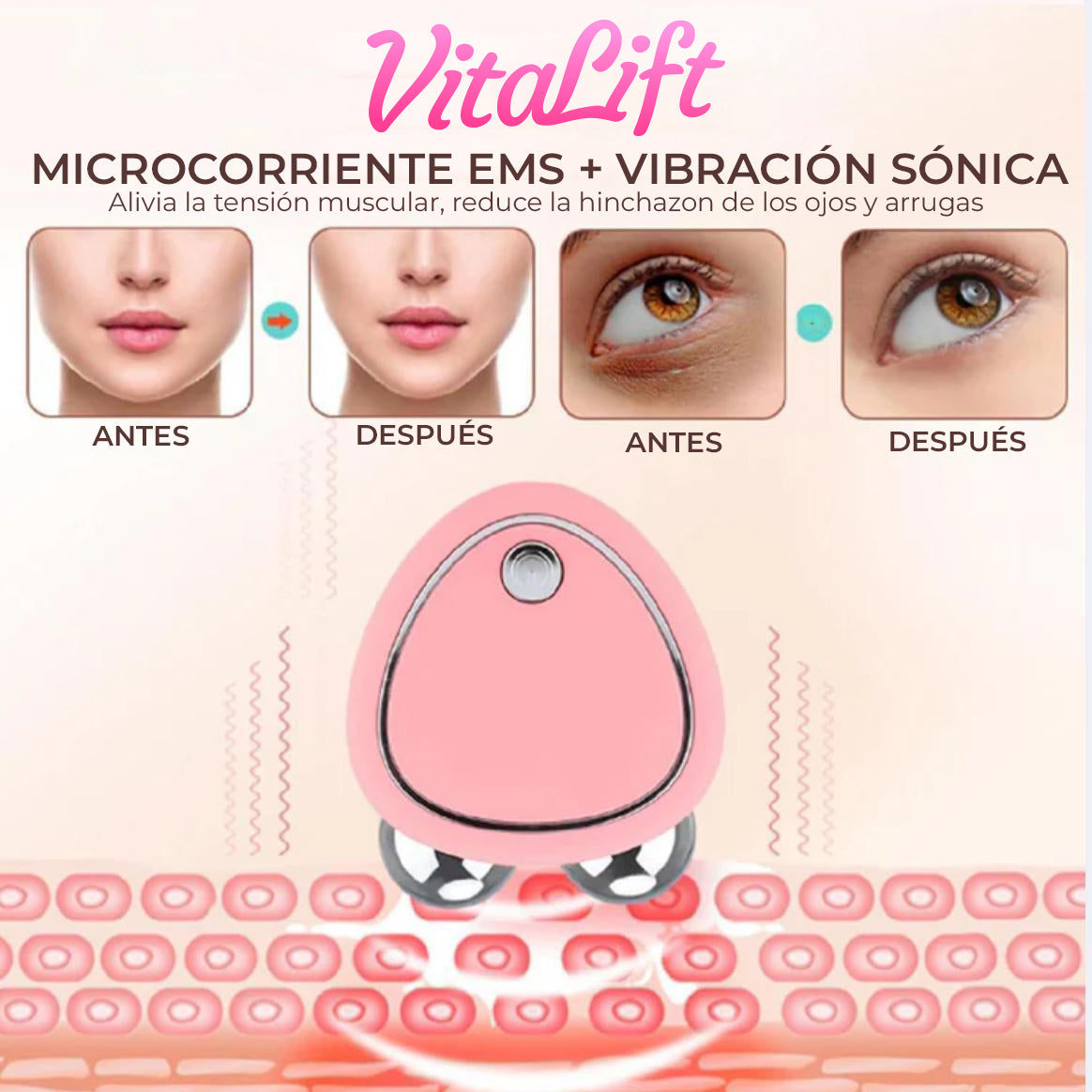 VitaLift™ - Estimulador facial tonificador y reafirmante