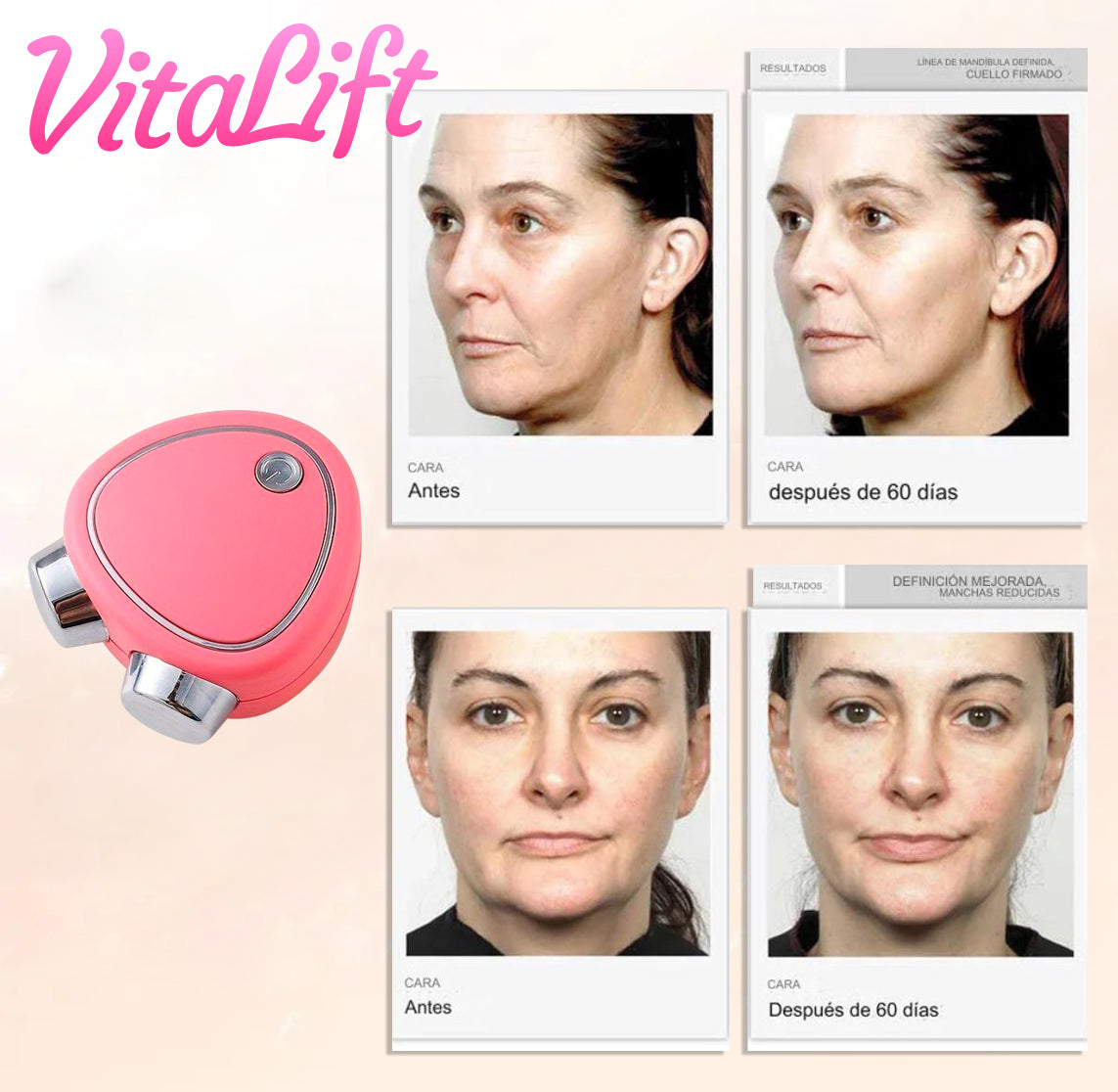 VitaLift™ - Estimulador facial tonificador y reafirmante