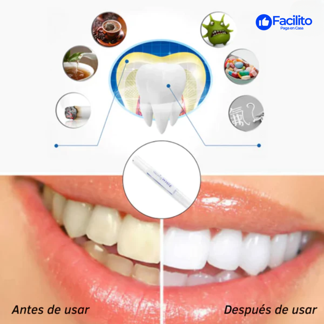 MySmile™ - Bolígrafo blanqueador de dientes (OFERTA  EXCLUSIVA  2 X 1)