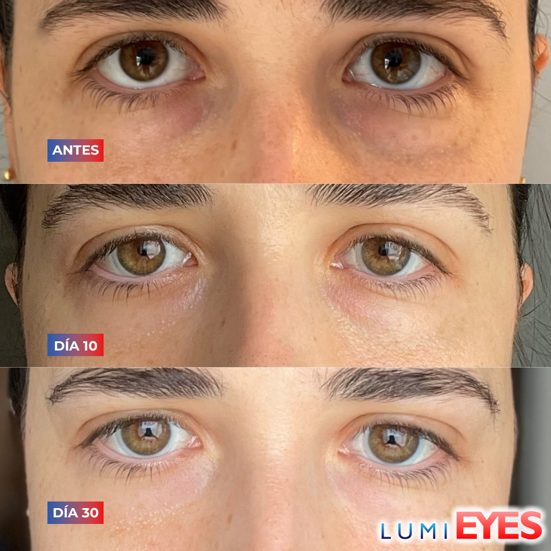 LumiEyes™ - Crema para contornos de ojos