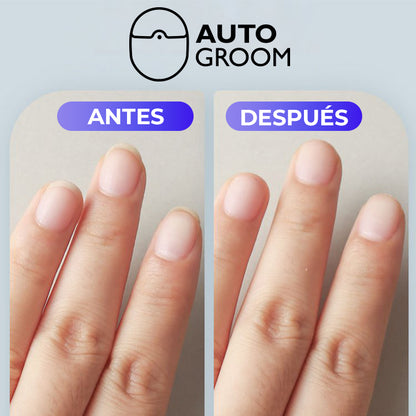 AutoGroom™ - Cortador de uñas automatico