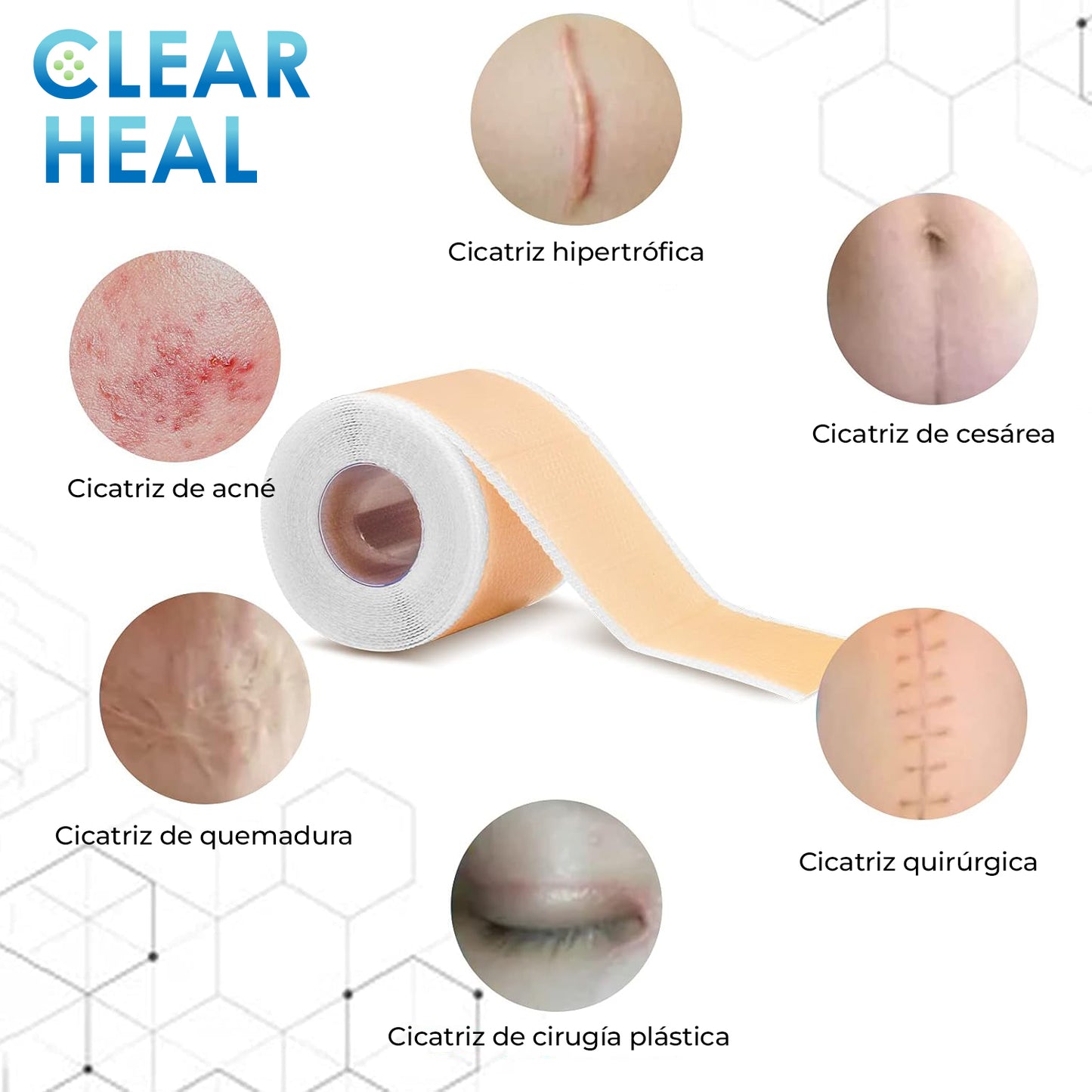 ClearHeal™ - Cinta de silicona para cicatrices