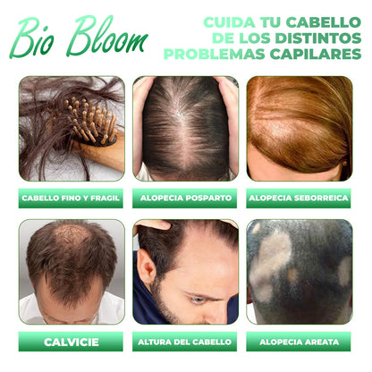 BioBloom™ - Spray capilar anti caida de cabello