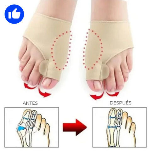 SoftStep™ - Corrector ortopédico de juanetes