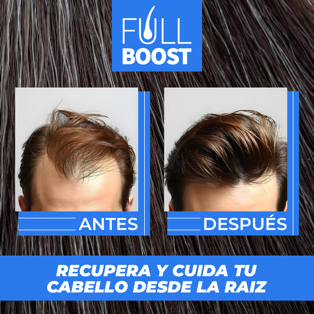 FullBoost™ - Spray Para Crecimento Capilar