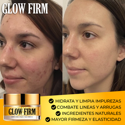 GlowFirm™ - Mascarilla Facial con Oro 24K