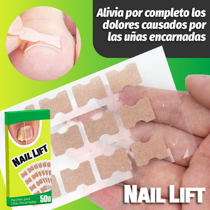 NailLift™ - Parches para Uñas Encarnadas
