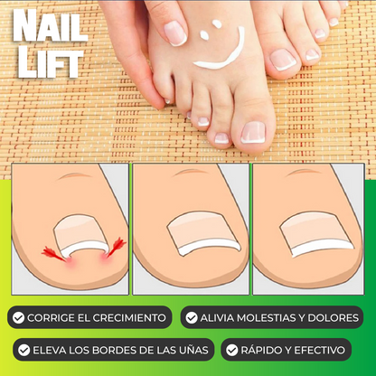 NailLift™ - Parches para Uñas Encarnadas