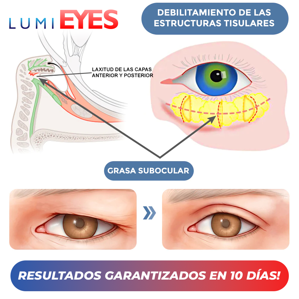 LumiEyes™ - Crema para contornos de ojos