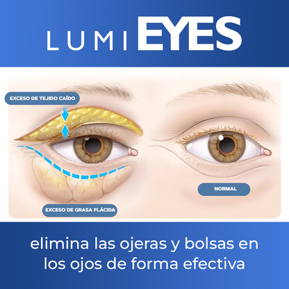 LumiEyes™ - Crema para contornos de ojos