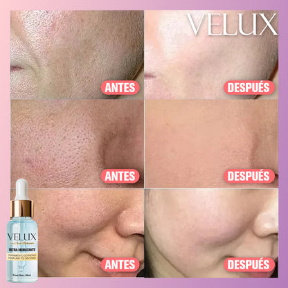 Velux™ - Serum + Primer Facial con Ácido Hialurónico