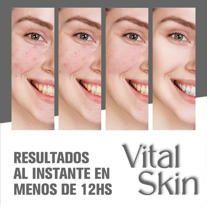 VitalSkin™ - Crema Limpiadora de Colageno