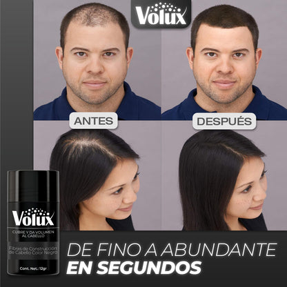 Volux™ - Dale Vida a tu Cabello en Segundos