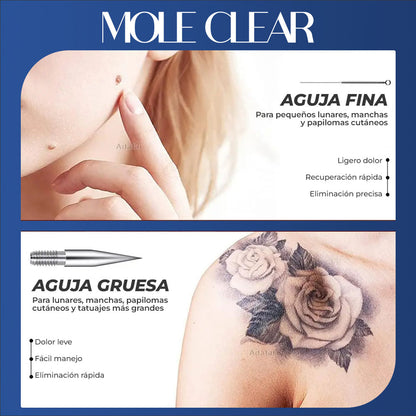 MoleClear™ - Lapiz de plasma para eliminar lunares