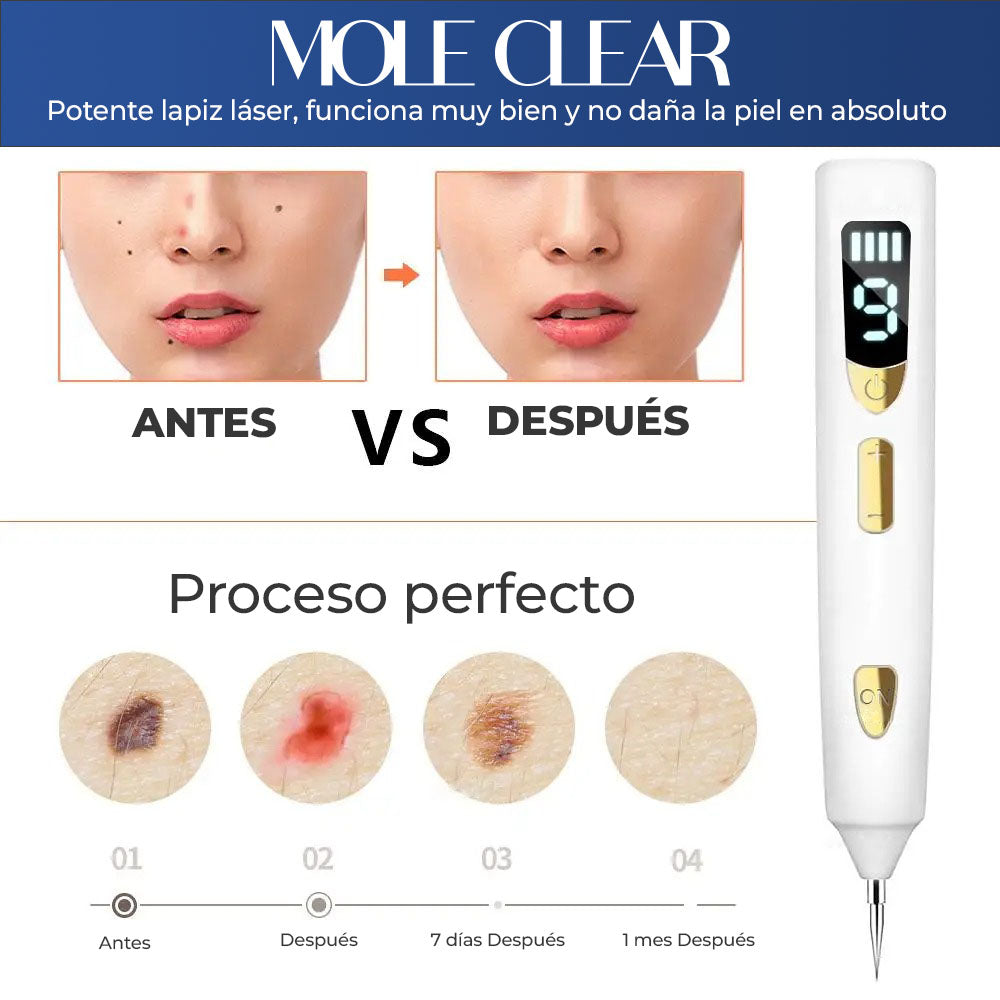 MoleClear™ - Lapiz de plasma para eliminar lunares