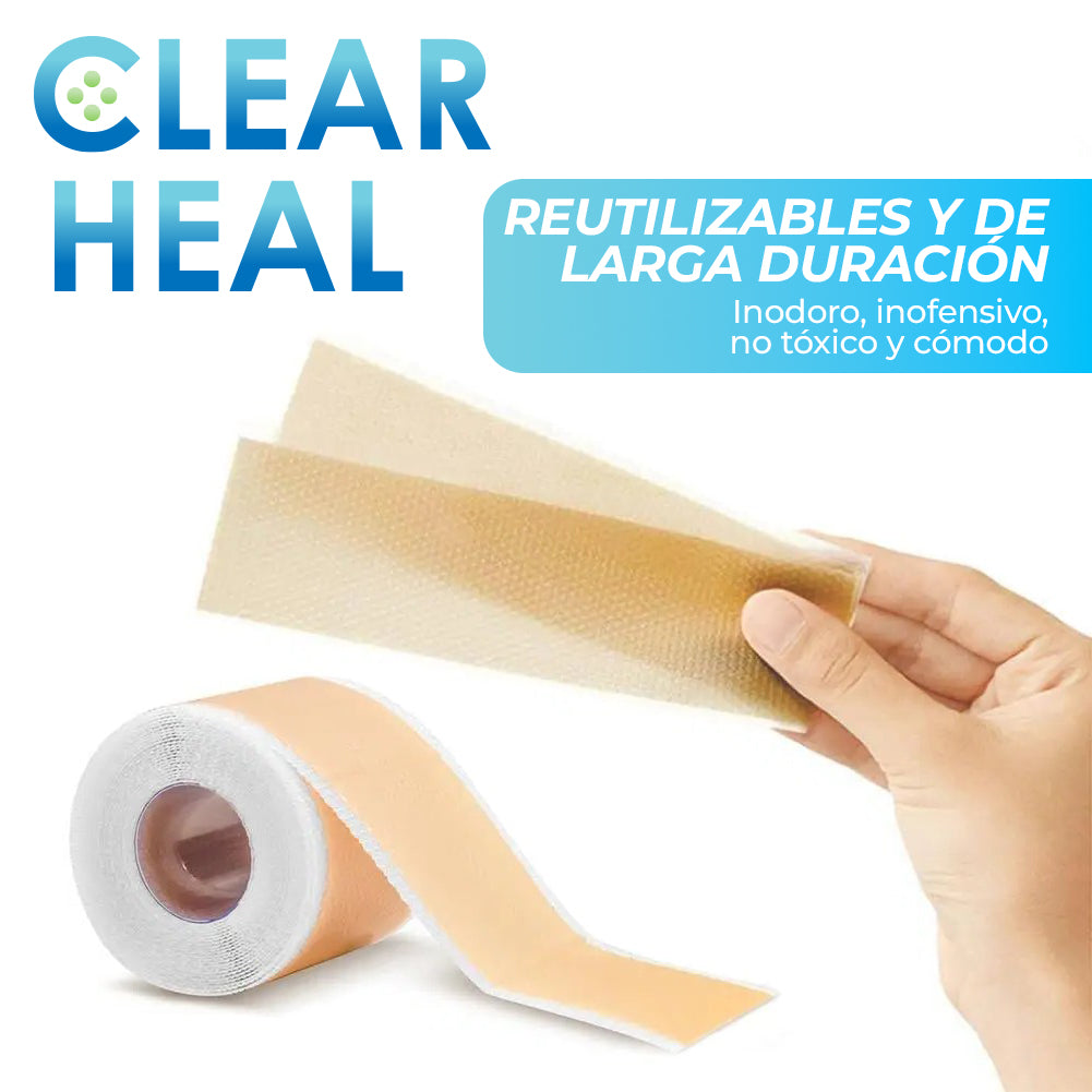 ClearHeal™ - Cinta de silicona para cicatrices