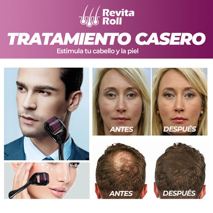 RevitaRoll™ - Rodillo de crecimiento capilar